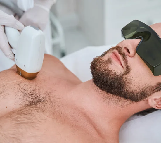 Épilation laser hommes