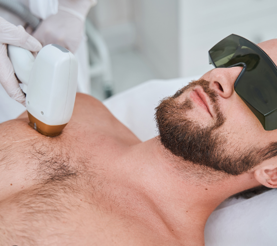 Épilation laser hommes